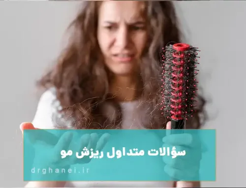 سوالات متداول ریزش مو