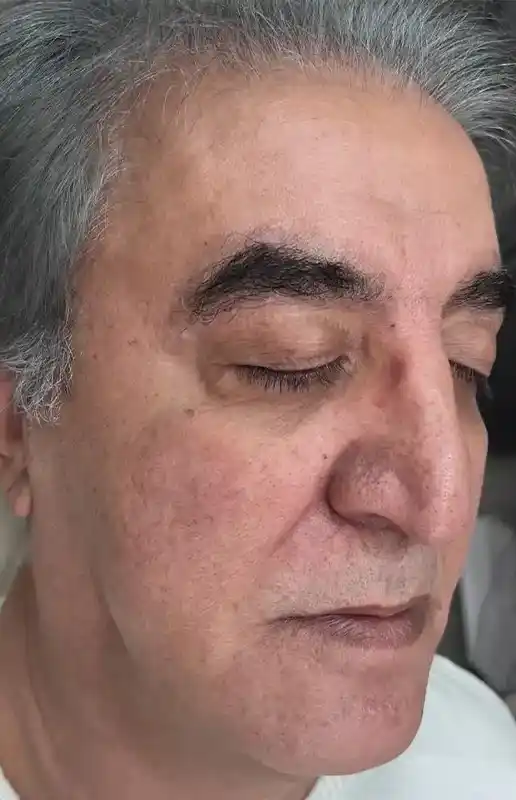 بعد از فوتونا