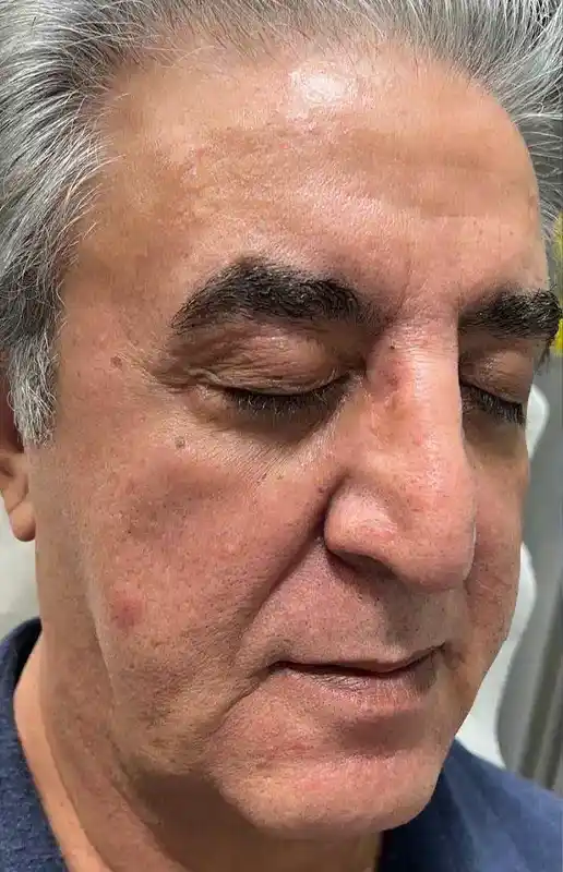 قبل از فوتونا