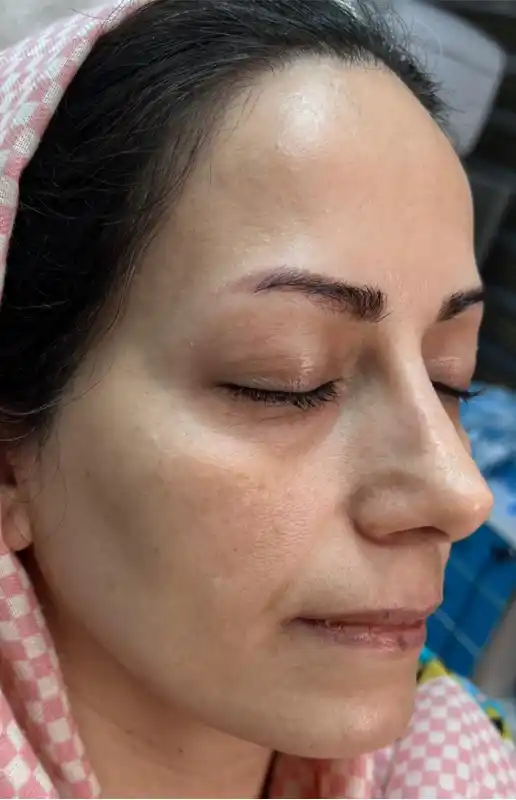 قبل از فوتونا