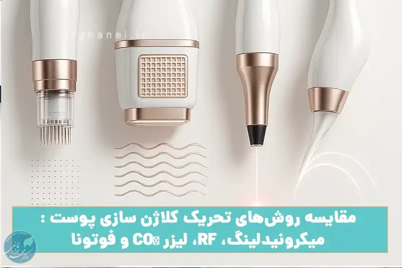 مقایسه روش‌های تحریک کلاژن سازی پوست : میکرونیدلینگ، RF، لیزر CO₂ و فوتونا