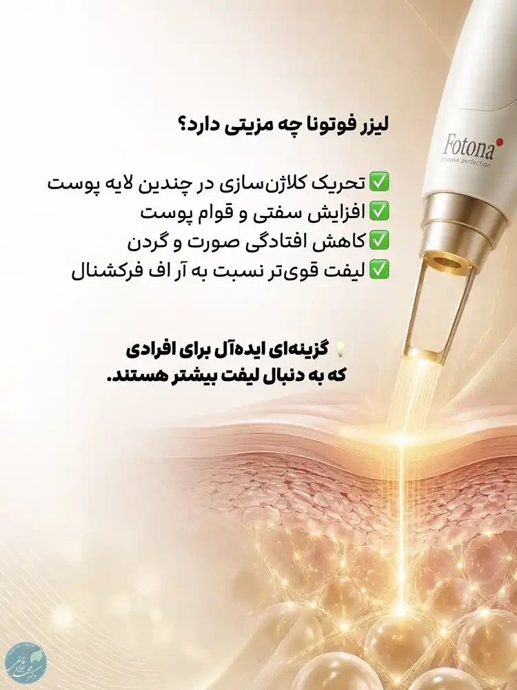 مزایای لیزر فوتونا
