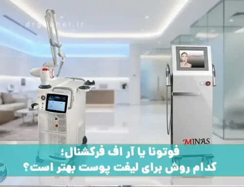 فوتونا یا آر اف فرکشنال؛ کدام روش برای لیفت پوست بهتر است؟