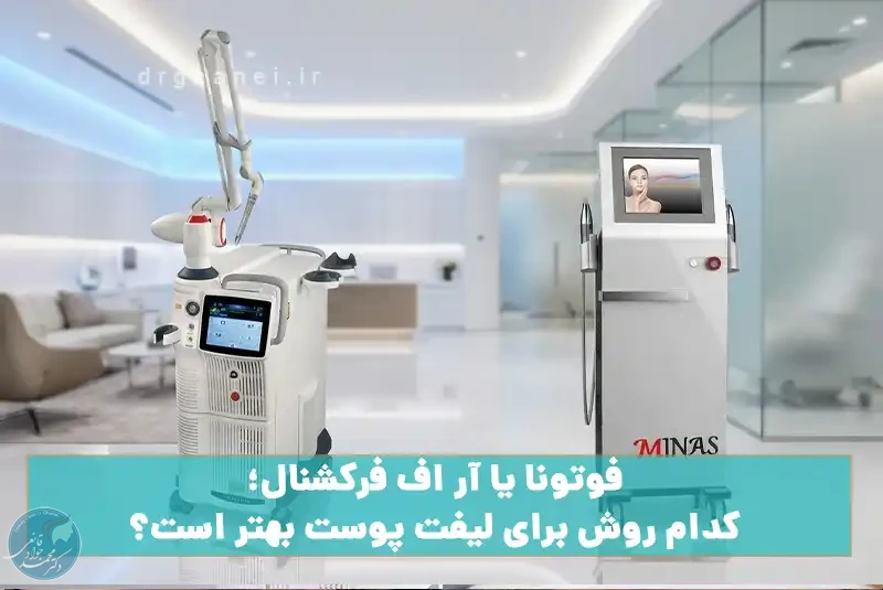 فوتونا یا آر اف فرکشنال؛ کدام روش برای لیفت پوست بهتر است؟