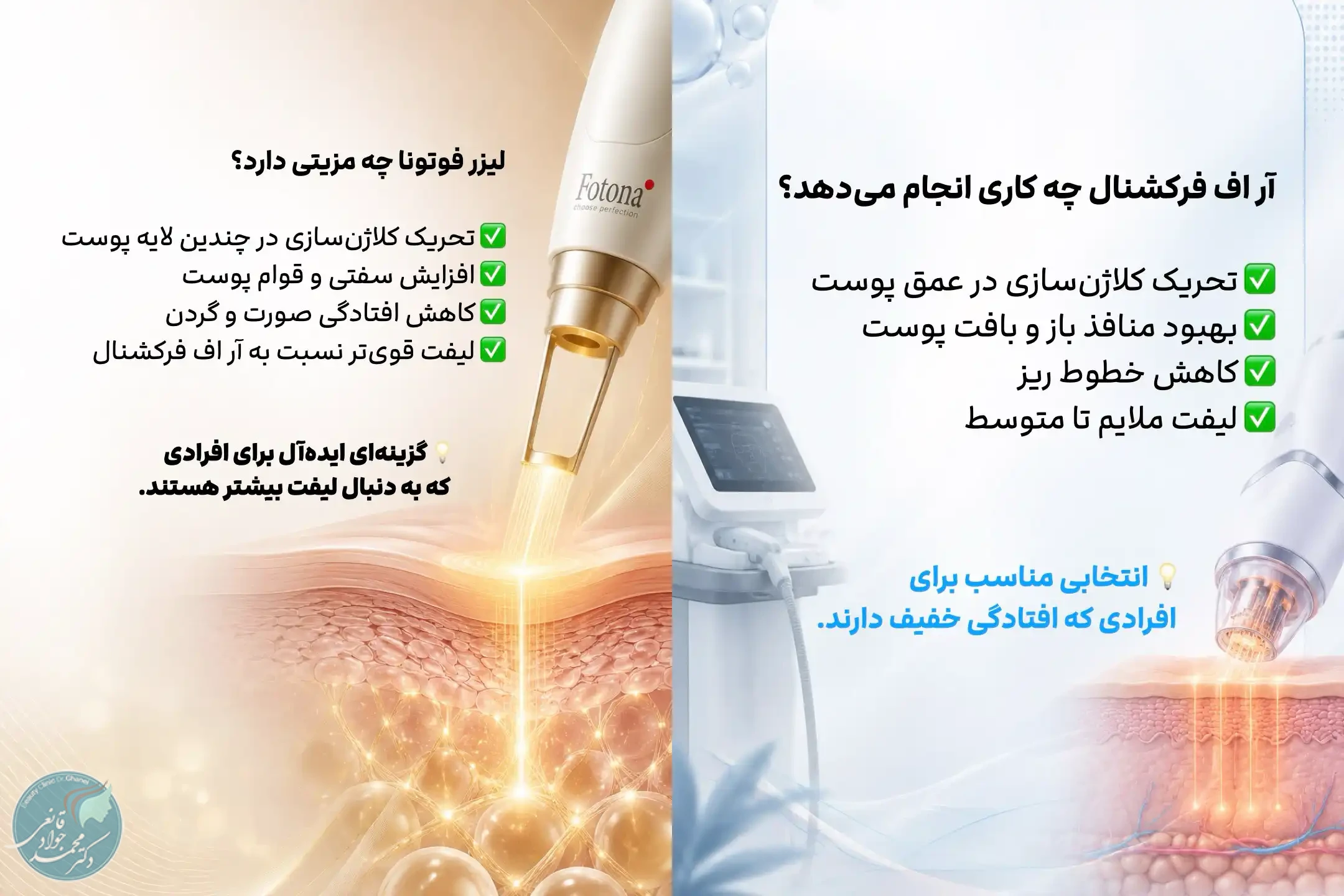مقایسه فوتونا و آر اف فرکشنال برای لیفت پوست