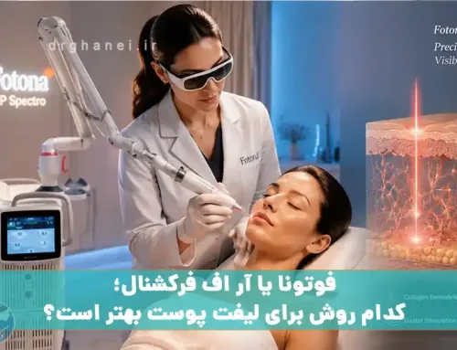 لیفت فوتونا چیست؟ مقایسه با لیفت جراحی، ماندگاری، مزایا و کاربردها (راهنمای کامل 2026)