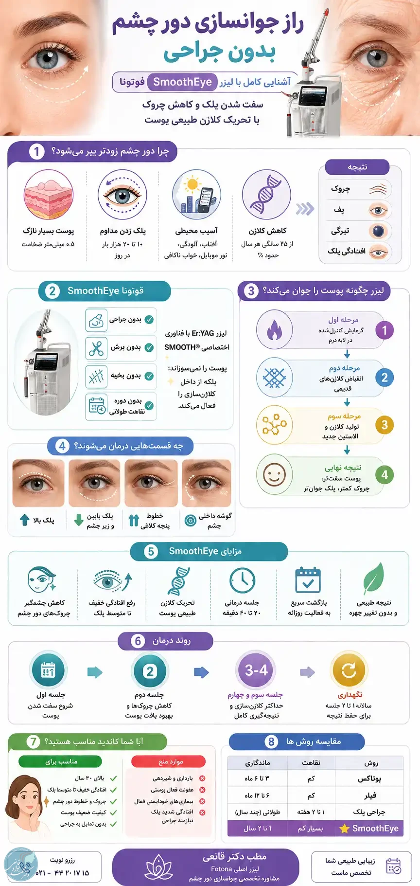 جوانسازی دور چشم با لیزر فوتونا (اسموت‌آی)