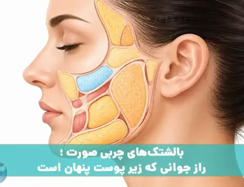 بالشتک‌های چربی صورت ؛ راز جوانی که زیر پوست پنهان است