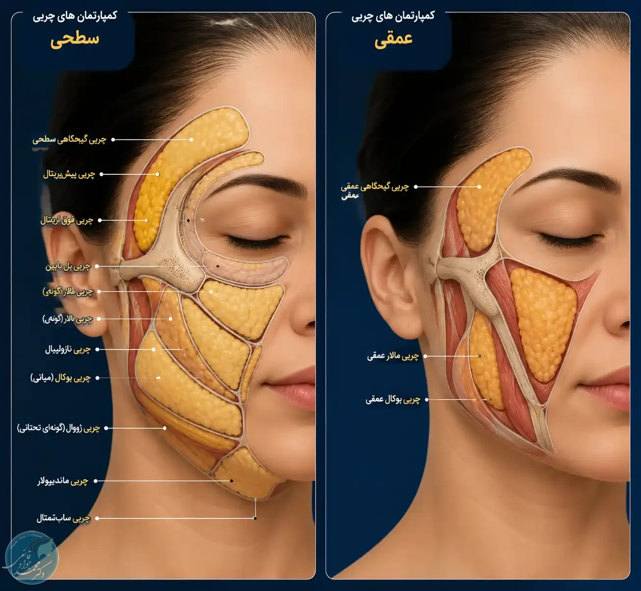 موقعیت کمپارتمانهای چربی سطحی در ناحیه گونه و اطراف دهان