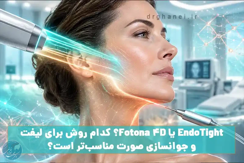 EndoTight یا Fotona 4D؟ کدام روش برای لیفت و جوانسازی صورت مناسبتر است؟